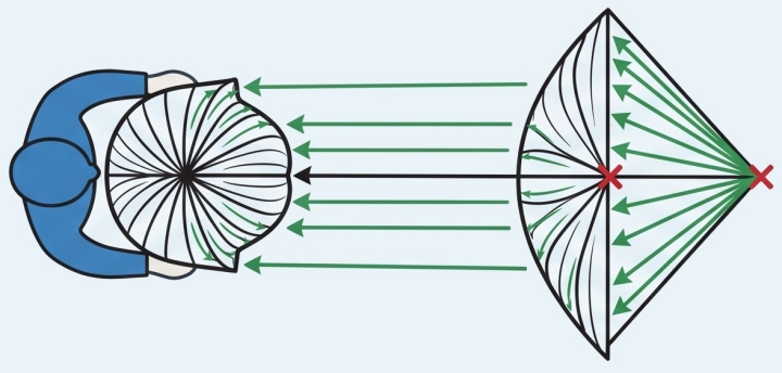K&ouml;rperhaltung beim Schneiden eines A-Linien-Bobs